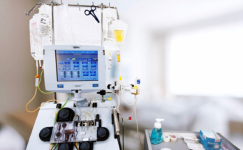 Therapeutic Plasma Exchange